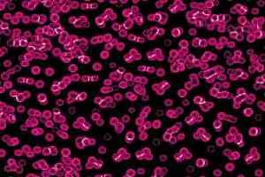 Ковролин Forbo Flotex Sottsass Bacteria 990101 фото  | FLOORDEALER