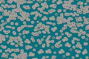 Ковролин Forbo Flotex Sottsass Bacteria 990404 фото  | FLOORDEALER