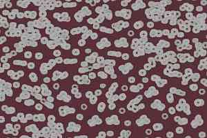 Ковролин Forbo Flotex Sottsass Bacteria 990402 фото  | FLOORDEALER