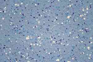 Линолеум Gerflor Tarasafe Ultra H2O 7413_Ocean_Blue фото  | FLOORDEALER