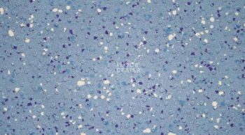 Линолеум Gerflor Tarasafe Ultra H2O 7413_Ocean_Blue фото 1 | FLOORDEALER