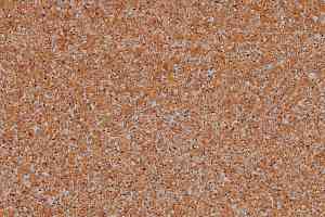 Линолеум Grabo Terrana Top Extra 4139-292 фото  | FLOORDEALER