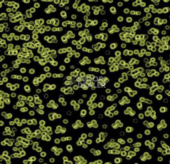 Ковролин Forbo Flotex Sottsass Bacteria 990103 фото 1 | FLOORDEALER
